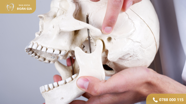 Điều trị đau khớp hàm